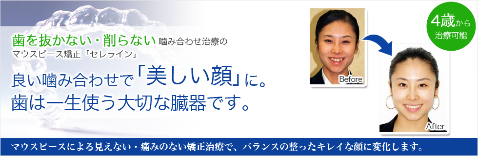歯を抜かない・削らない 噛み合わせ治療のセレライン矯正歯科
